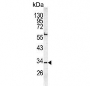 Western blot testing of human HL60 cell lysate with CAPZA1 antibody. Predicted molecular weight ~33 kDa.