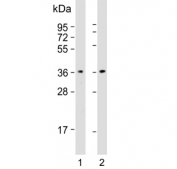 Western blot testing of human 1) A431 and 2) Jurkat cell lysate with CAPZA1 antibody. Predicted molecular weight ~33 kDa.
