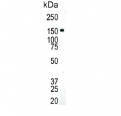 Western blot testing of human SK-BR-3 cell lysate with IGF1 Receptor antibody. Expected molecular weight: ~69 kDa (unglycosylated beta chain) up to ~200 kDa (glycosylated pro-form).