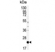 Western blot testing of mouse NIH 3T3 cell lysate with Phosphatidylethanolamine-binding protein 1 antibody. Predicted molecular weight ~21 kDa.