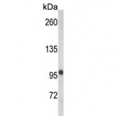 Western blot testing of mouse brain tissue lysate with VPS53 antibody. Predicted molecular weight ~94 kDa.