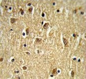 IHC testing of FFPE human brain tissue with PTK2 antibody. HIER: steam section in pH6 citrate buffer for 20 min and allow to cool prior to staining.