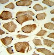 IHC testing of FFPE human skeletal muscle tissue with CAV2 antibody. HIER: steam section in pH6 citrate buffer for 20 min and allow to cool prior to staining.