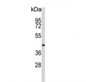 Western blot testing of human MDA-MB-435 cell lysate with PHYH antibody. Predicted molecular weight ~39 kDa.