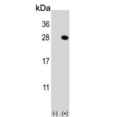 Western blot testing of 1) non-transfected and 2) transfected 293 cell lysate with QDPR antibody.