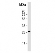 Western blot testing of human liver tissue lysate with QDPR antibody. Predicted molecular weight ~26 kDa.