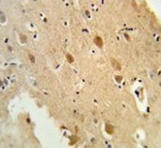 IHC testing of FFPE human brain tissue with Galactosylceramide sulfotransferase antibody. HIER: steam section in pH6 citrate buffer for 20 min and allow to cool prior to staining.