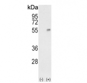 Western blot testing of 1) non-transfected and 2) transfected 293 cell lysate with Haptoglobin antibody.