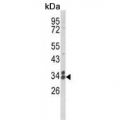 Western blot testing of human MDA-MB-231 cell lysate with Clathrin Light Chain A antibody. Expected molecular weight: 24-27 kDa.