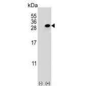 Western blot testing of 1) non-transfected and 2) transfected 293 cell lysate with Clathrin Light Chain A antibody.