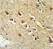 IHC testing of FFPE human brain tissue with RPL18A antibody. HIER: steam section in pH6 citrate buffer for 20 min and allow to cool prior to staining.
