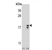 Western blot testing of 1) non-transfected and 2) transfected 293 cell lysate with COX6A1 antibody.