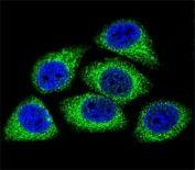 Immunofluorescent staining of human HeLa cells with DEK antibody (green) and DAPI nuclear stain (blue).