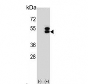 Western blot testing of 1) non-transfected and 2) transfected 293 cell lysate with Ataxin 3 antibody.