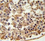 IHC testing of FFPE human testis tissue with FANCC antibody. HIER: steam section in pH6 citrate buffer for 20 min and allow to cool prior to staining.