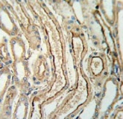 IHC testing of FFPE human lung tissue with ADH7 antibody. HIER: steam section in pH6 citrate buffer for 20 min and allow to cool prior to staining.