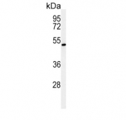 Western blot testing of mouse liver tissue lysate with ZDHHC9 antibody. Expected molecular weight: 41-46 kDa.