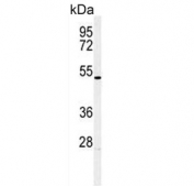 Western blot testing of human HL60 cell lysate with HOXA3 antibody. Predicted molecular weight ~46 kDa.
