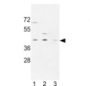 Western blot testing of human 1) MDA-MB-231, 2) CCRF-CEM and 3) HL60 cell lysate with PRPF38A antibody. Predicted molecular weight ~37 kDa.
