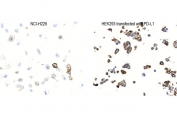 IHC staining of FFPE human NCI-H226 cells (left) and PD-L1 transfected HEK293 cells (right) with PD-L1 antibody. HIER: steam section in pH9 EDTA buffer for 20 min and allow to cool prior to staining.