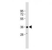 Western blot testing of human HepG2 cell lysate with HSD17B13 antibody. Predicted molecular weight: ~34 kDa.