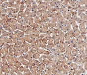 IHC testing of FFPE human liver tissue with HSD17B13 antibody. HIER: steam section in pH9 EDTA buffer for 20 min and allow to cool prior to staining.
