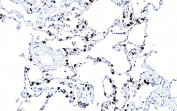 IHC testing of FFPE human lung tissue with SFTPC antibody. HIER: steam section in pH6 citrate buffer for 20 min and allow to cool prior to staining.