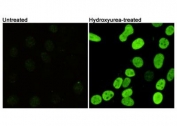 Immunofluorescent staining of mouse NIH 3T3 cells untreated (left) and treated (right) with Hydroxyurea, using Phospho-Histone H2AX antibody.