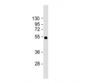 Western blot testing of mouse lung tissue lysate with SLC29A1 antibody.  Predicted molecular weight ~50 kDa.