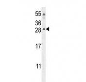 Western blot testing of mouse heart tissue lysate with Claudin 6 antibody.  Predicted molecular weight ~23 kDa.
