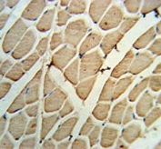 IHC testing of FFPE human skeletal muscle tissue with YTHDF3 antibody. HIER: steam section in pH6 citrate buffer for 20 min and allow to cool prior to staining.