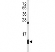 Western blot testing of mouse liver tissue lysate with HBA2 antibody.  Predicted molecular weight ~15 kDa.