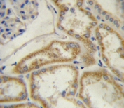 IHC testing of FFPE human kidney tissue with Natriuretic peptide receptor C antibody. HIER: steam section in pH6 citrate buffer for 20 min and allow to cool prior to staining.
