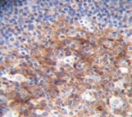 IHC staining of FFPE human tonsillitis tissue with MARCO antibody. HIER: steam section in pH6 citrate buffer for 20 min and allow to cool prior to staining.