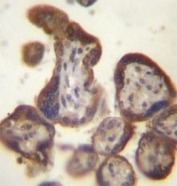 IHC staining of FFPE human placental tissue with Choriogonadotropin beta antibody. HIER: steam section in pH6 citrate buffer for 20 min and allow to cool prior to staining.