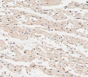 IHC staining of FFPE human heart tissue with CRCL antibody. HIER: steam section in pH9 EDTA buffer for 20 min and allow to cool prior to staining.