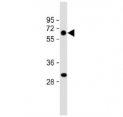 Western blot testing of human lung tissue lysate with CRCL antibody. Predicted molecular weight ~53 kDa.