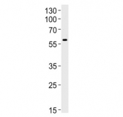 Western blot testing of human brain tissue lysate with Syncytin 1 antibody. Predicted molecular weight: 60~80 kDa depending on glycosylation level.
