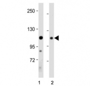 Western blot testing of 1) human brain and 2) mouse brain tissue lysate with Ephrin type-A receptor 4 antibody. Expected molecular weight: ~109 kDa and ~104 kDa (two isoforms) but the protein may be observed at higher molecular weights due to glycosylation.