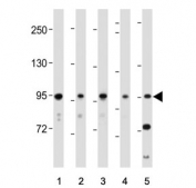 Western blot testing of 1) human HeLa, 2) HUVEC, 3) human NCI-H460, 4) human brain and 5) mouse NIH 3T3 cell lysate with Ephrin type-A receptor 4 antibody. Expected molecular weight: ~109 kDa and ~104 kDa (two isoforms) but the protein may be observed at higher molecular weights due to glycosylation.