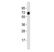 Western blot testing of human testis tissue lysate with ZFP91 antibody. Predicted molecular weight ~63 kDa and ~60 kDa (two isoforms).