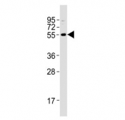 Western blot testing of human HL60 cell lysate with ZFP91 antibody. Predicted molecular weight ~63 kDa and ~60 kDa (two isoforms).