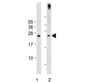 Western blot testing of human 1) Jurkat and 2) Raji cell lysate with Phorbolin 1 antibody. Predicted molecular weight ~23 kDa.