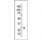 Western blot testing of human A549 cell lysate with WISP-2 antibody. Predicted molecular weight ~27 kDa.