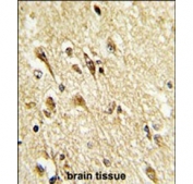 IHC staining of FFPE human brain tissue with VGluT2 antibody. HIER: steam section in pH6 citrate buffer for 20 min and allow to cool prior to staining.