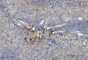 IHC staining of FFPE mouse spleen tissue with GREM1 antibody. HIER: steam section in pH6 citrate buffer for 20 min and allow to cool prior to staining.