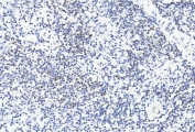 IHC staining of FFPE human spleen tissue with GREM1 antibody. HIER: steam section in pH6 citrate buffer for 20 min and allow to cool prior to staining.