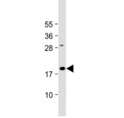 Western blot testing of mouse skeletal muscle tissue lysate with GREM1 antibody. Predicted molecular weight ~21 kDa.
