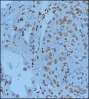 IHC staining of FFPE human renal tissue with GREM1 antibody. HIER: steam section in pH6 citrate buffer for 20 min and allow to cool prior to staining.