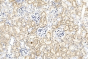 IHC staining of FFPE mouse kidney tissue with GREM1 antibody. HIER: steam section in pH6 citrate buffer for 20 min and allow to cool prior to staining.